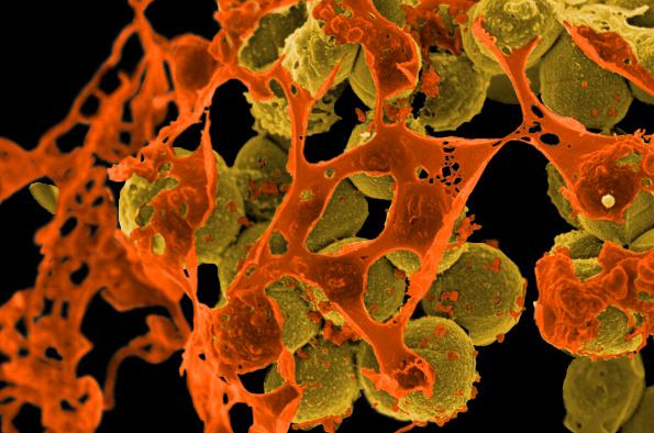 Image of bacteria