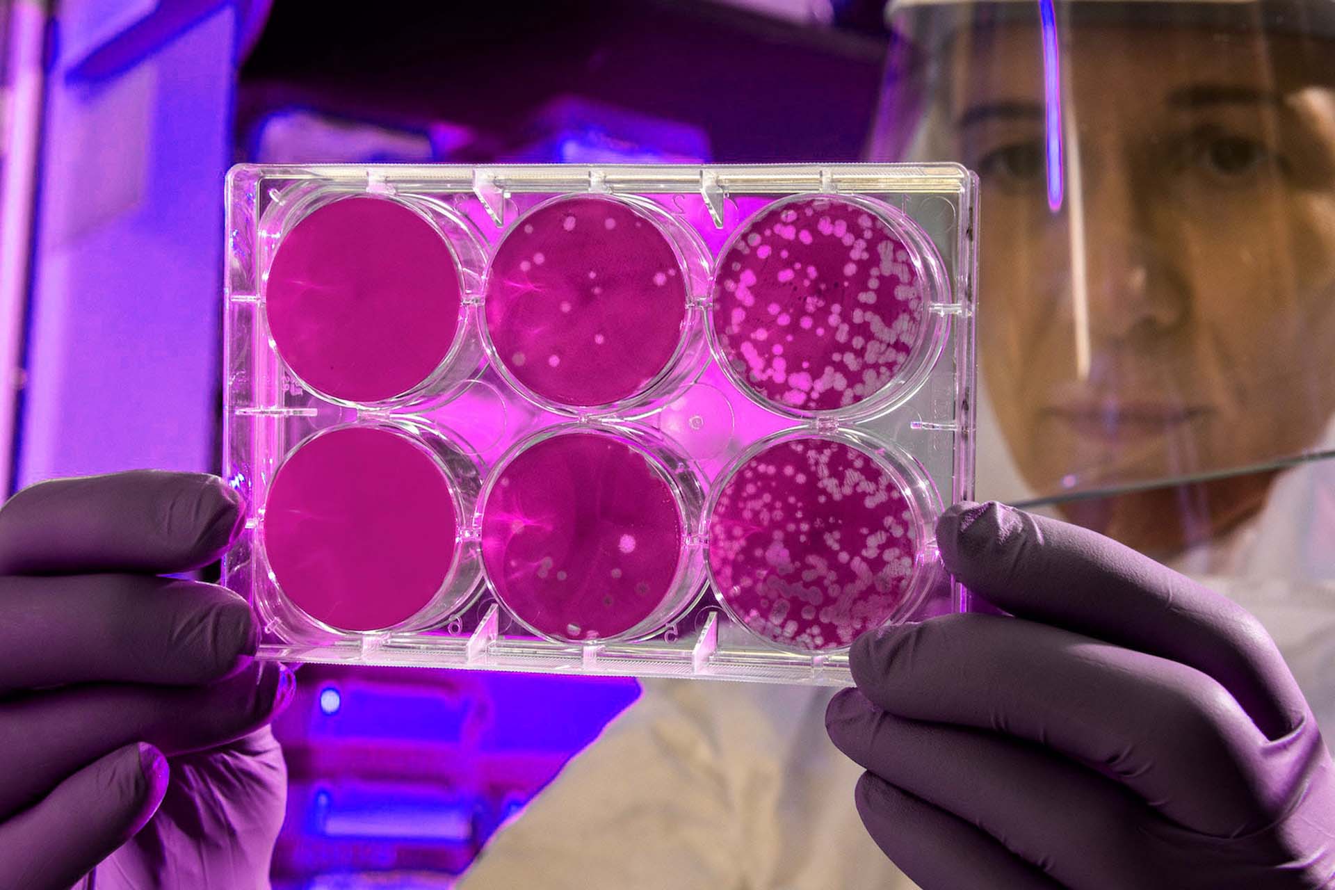 A scientist looks at 6 petri dish samples