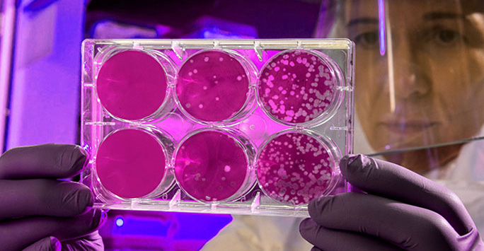 A scientist looks at 6 petri dish samples