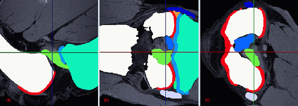 NUMERICAL SIMULATION