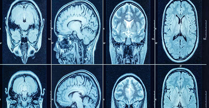 Brain scan images