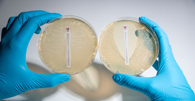 Tests performed on bacteria in CEIDR lab