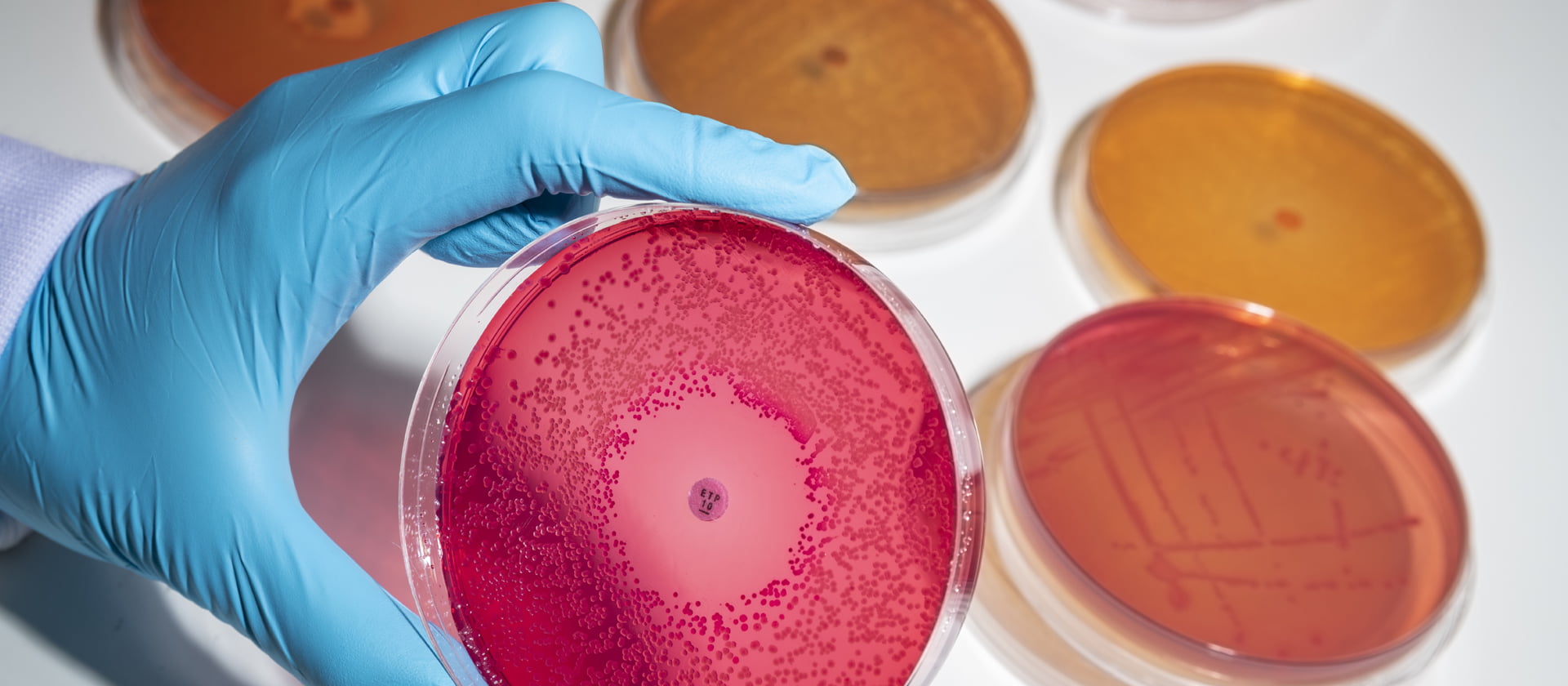 Bacteria in petri dish