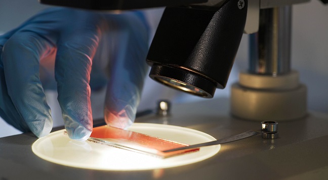 a slide is being prepared for a microscope