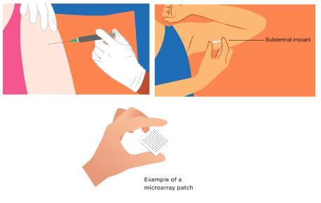 an illutration of a person receiving an injection in the arm, another person holding an implant to their arm and a hand holding a microarray patch