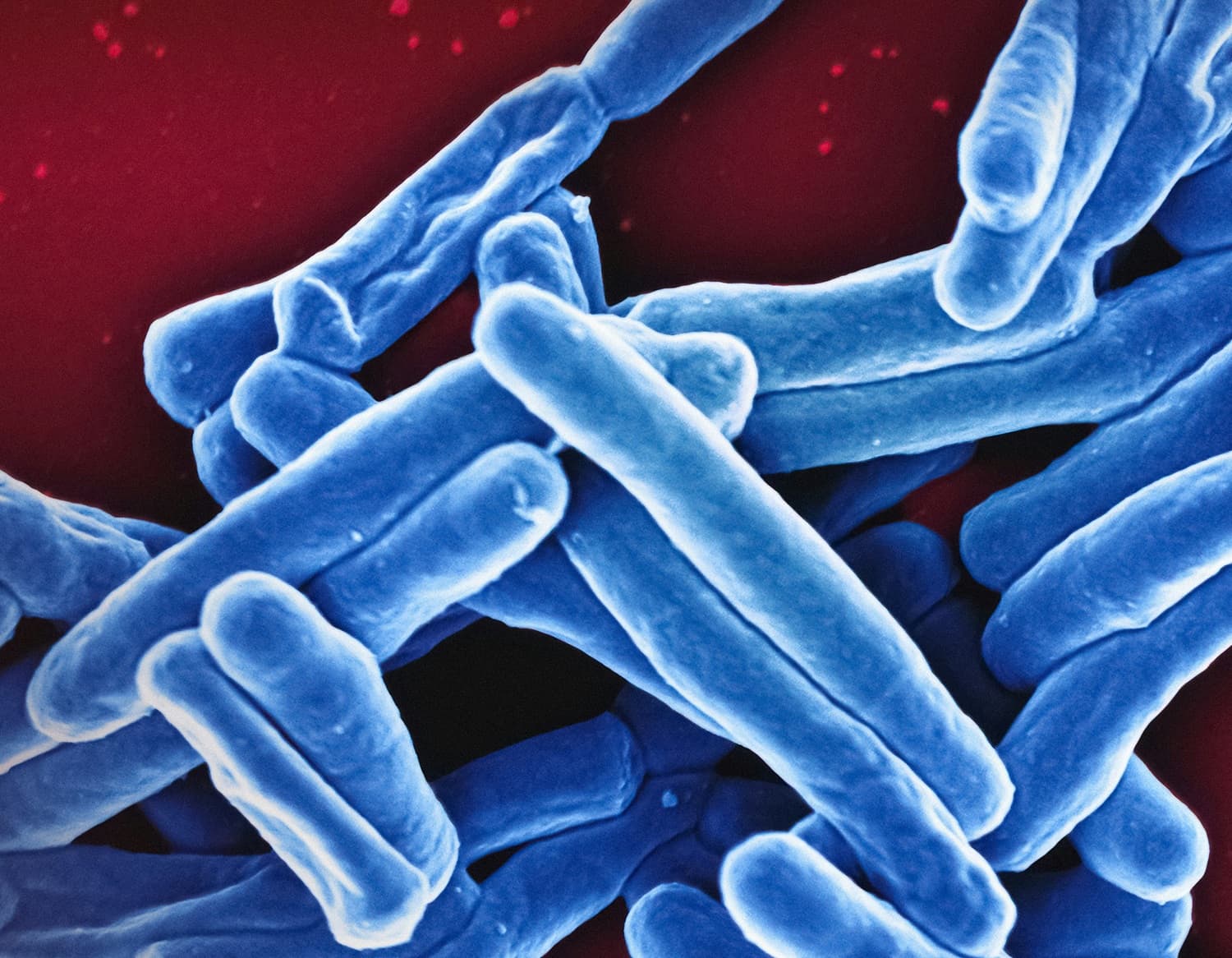 Mycobacterium Tuberculosis Bacteria Scanning electron micrograph of Mycobacterium tuberculosis particles (colorized blue), the bacterium which causes TB. Credit: NIAID