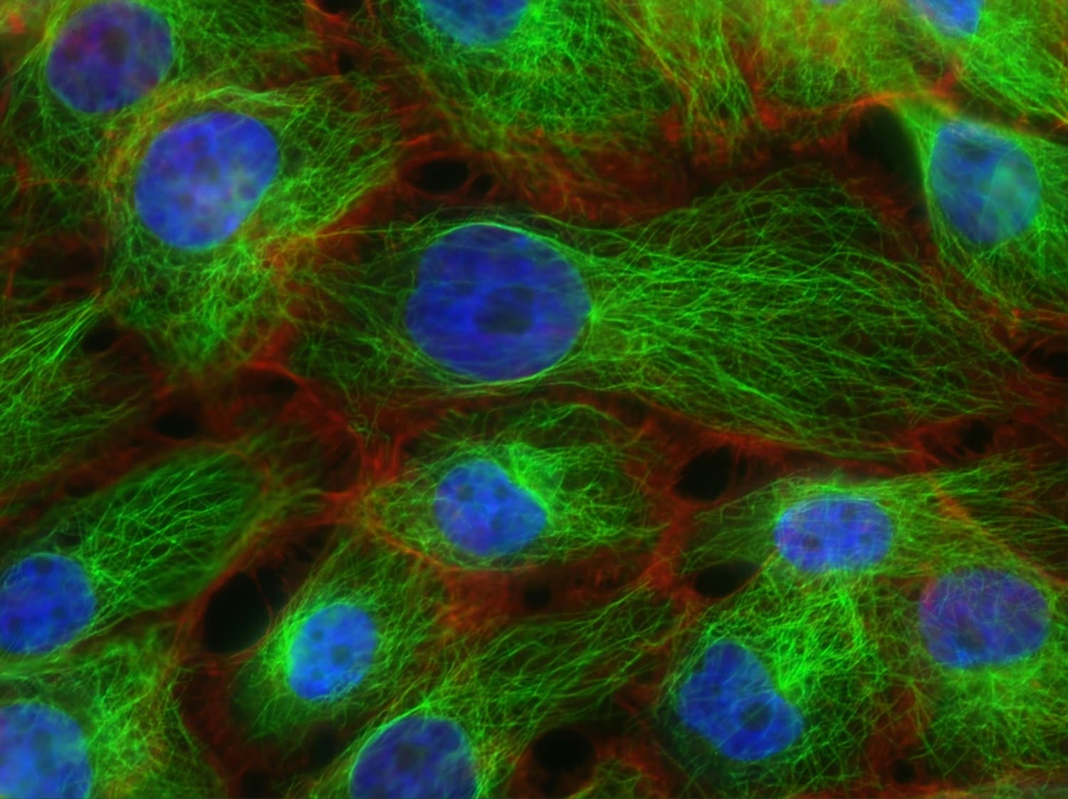 Stress fibers and microtubules in human breast cancer cells. Created by Christina Stuelten, Carole Parent, 2011, for the National Cancer Institute