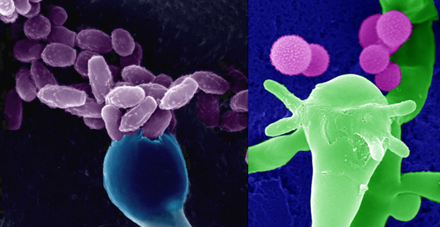 Scanning Electron Micrograph of the Cryptococcus neoformans yeast producing spores