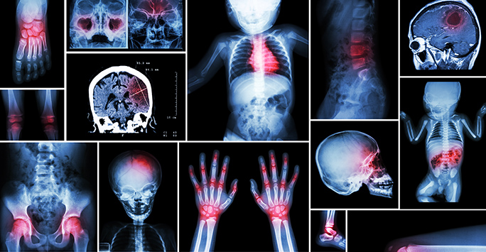 Bone Health X-Ray Image