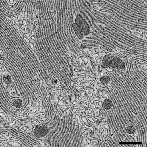 Pancreatic acinar cell