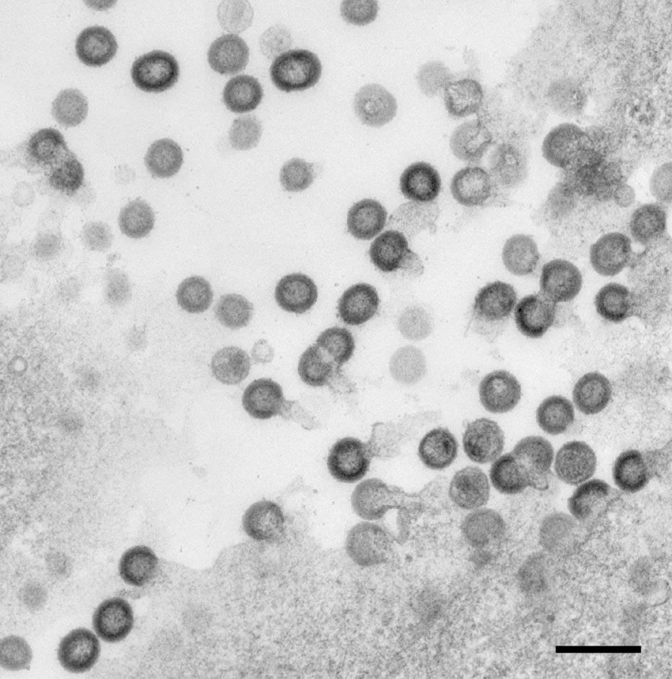 HIV Gag protein induces viral-like particles that bud from the HeLa cell surface. Bar = 500nm.