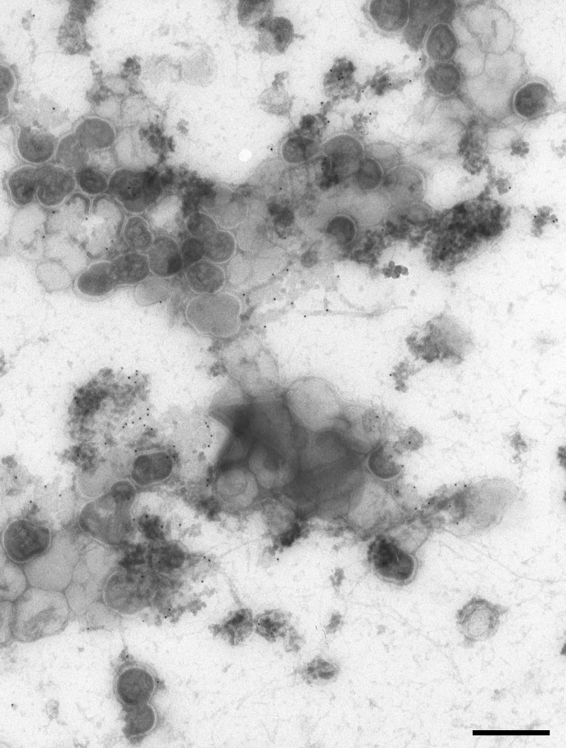 HeLa cell Gag (HIV protein)-induced viral like particles on 2D plasma membrane sheets. Bar = 500nm