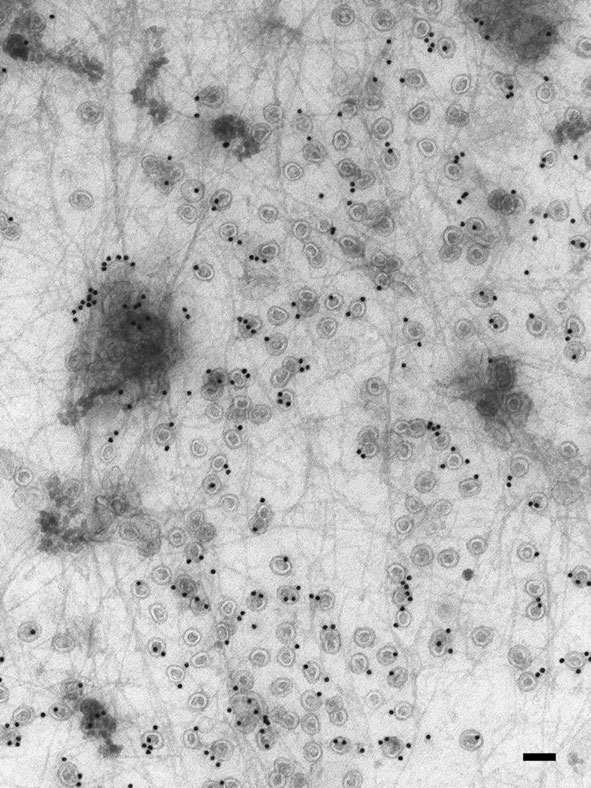 Caveolae and actin cytoskeleton on 2D flat sheet of plasma membrane. See method. Bar = 100nm. 