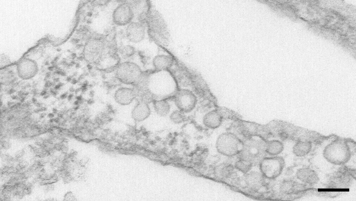 A7r5 cell interconnected caveolae. Ultrathin section containing 1D view of plasma membrane. Bar = 100nm.