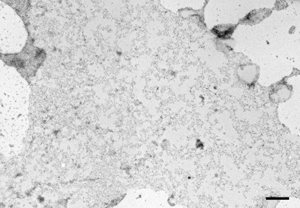 Whole T-cell basal plasma membrane sheet showing highly clustered microdomain gold probe. Bar = 500nm