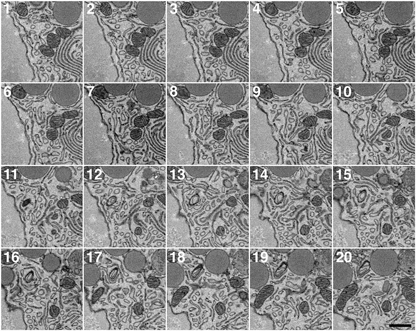 Montage of 20 high resolution serial sections.