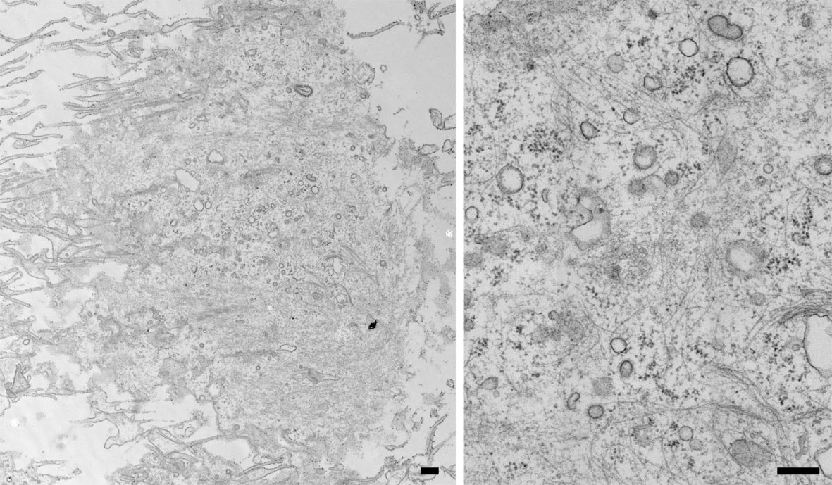 Ultrathin section containing 2D view of basal HeLa plasma membrane. See clathrin-coated vesicles and protein complexes. Bar = 500nm.