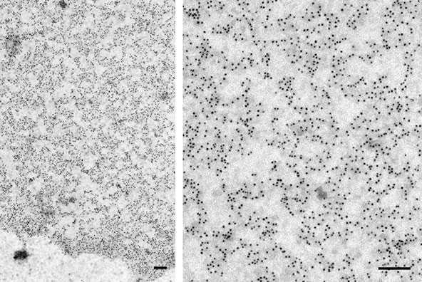 Lipid rafts. Immuno-gold labelling reveals cell surface clustering of cholesterol-sensitive nanoclusters (Prior IA et al, 2005). Bars = 100nm.