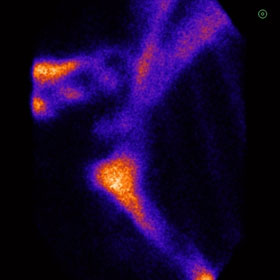 Equine bone scan