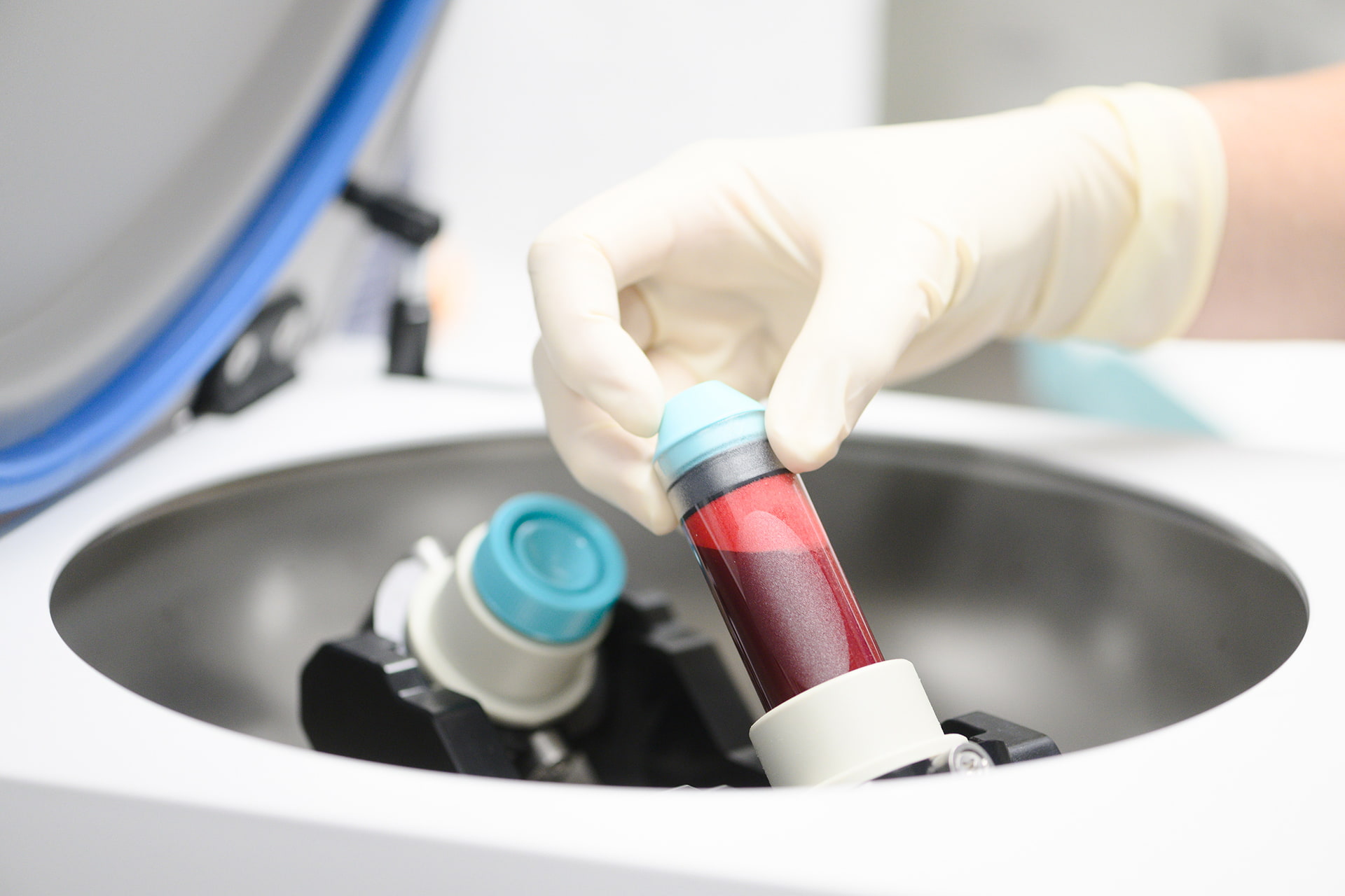 Blood sample in centrifuge