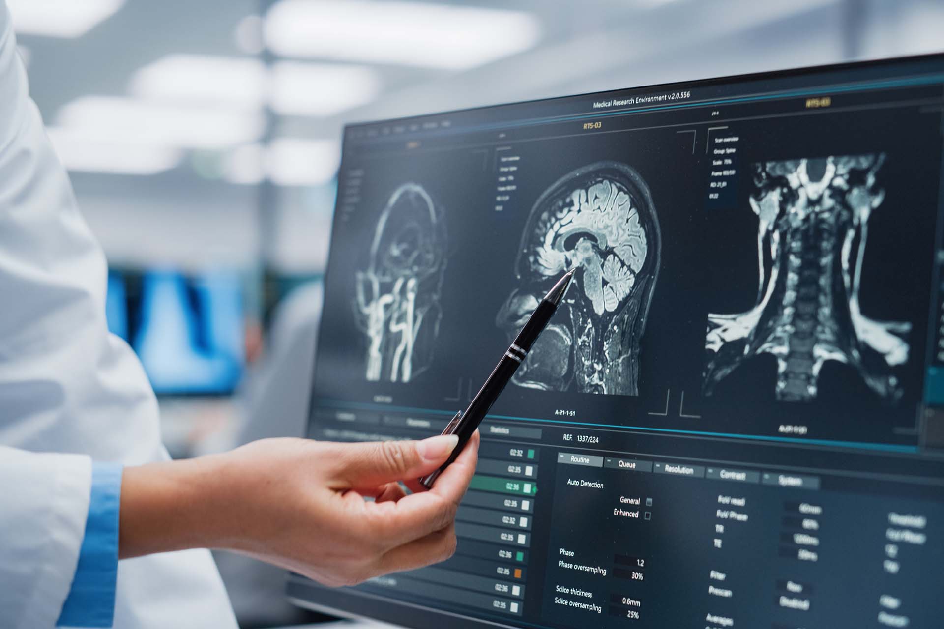 image of a brain scan on a computer screen being observed by a doctor
