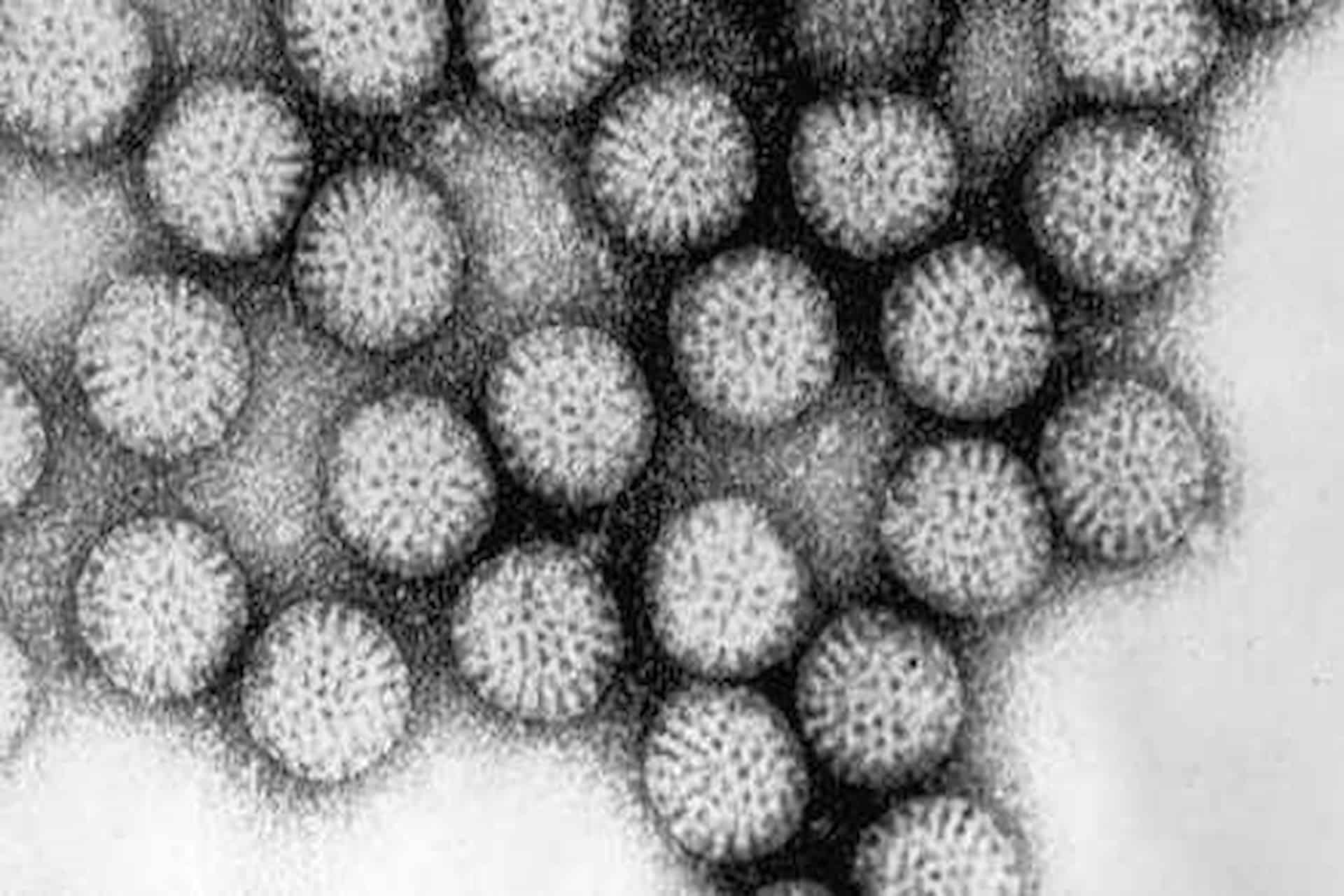 Ротавирус грипп. Ротавирус под микроскопом. Ротавирус электронная микроскопия. Ротавирусная инфекция под микроскопом. Ротавирусная инфекция под под микроскопом.
