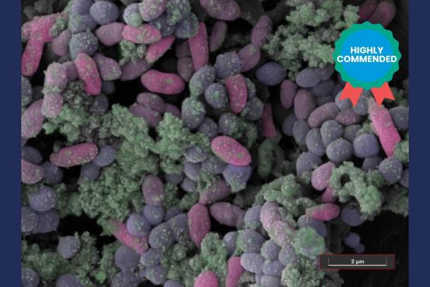 Pictured is a multispecies bacterial biofilm grown in synthetic cystic fibrosis (CF) sputum medium.