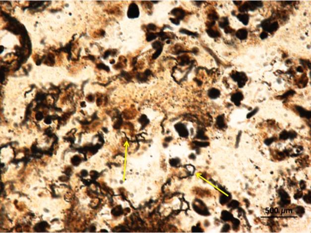 Treponema spp. bacteria are spiral 