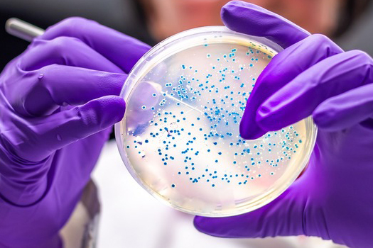 Researcher looking at bacteria in petri dish