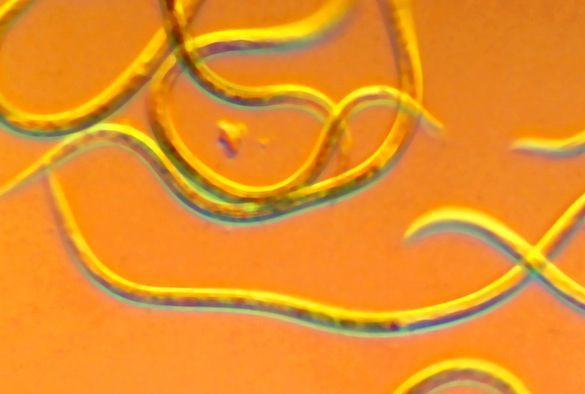 Parasite under microscope