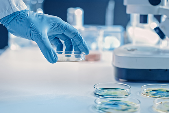 Scientist works with Petri Dishes with various bacteria