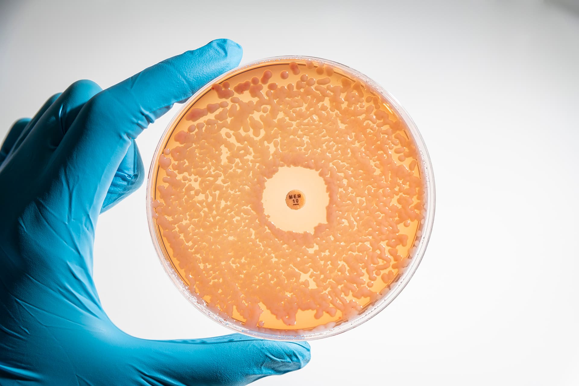 Plate showing antimicrobial resistance