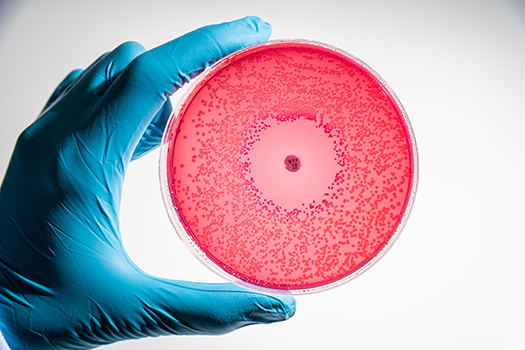 Image of bacteria in petri dish