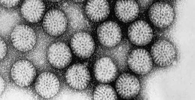 Virus as seen in microscope