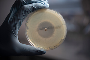 Image of Petri Dish