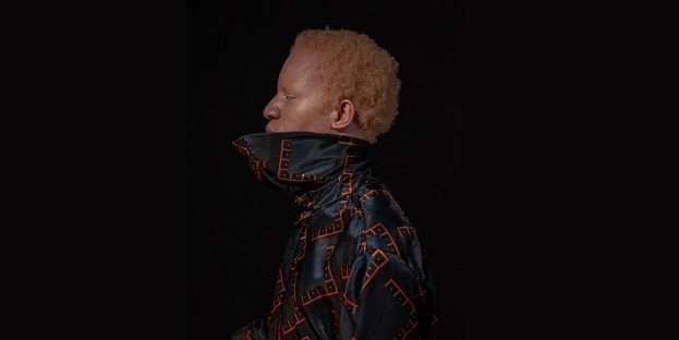 A side-profile image of a male with Albinism