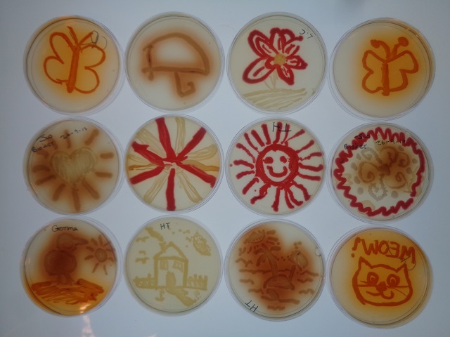petri dishes with colourful bacterial pictures