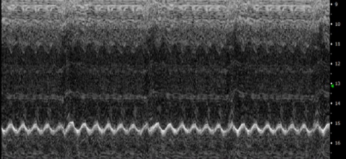 Motion mode (M- mode) image of a healthy murine heart showing cardiac R-wave.