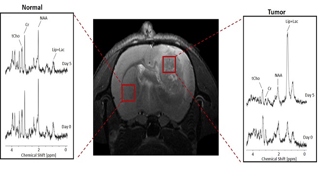 Magnetic Resonance Spectroscopy (MRS) showing the difference between normal brain and tumor in a rat model