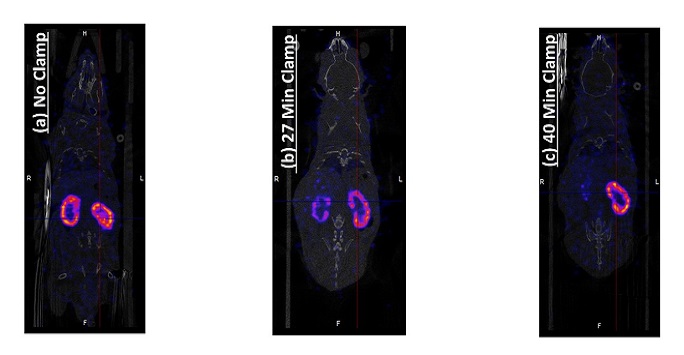 single photon emission computerized tomography (SPECT) imaging