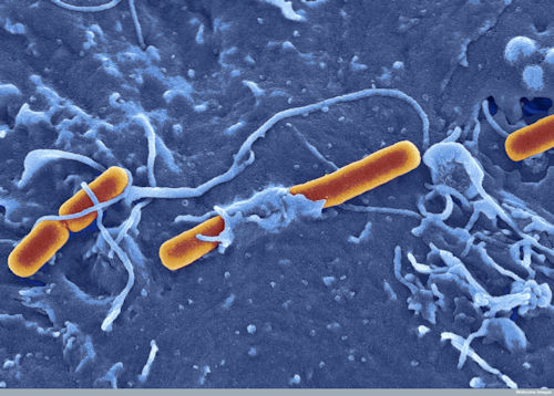 LCMH is modelling Shigella, a priority organism identified by the WHO.