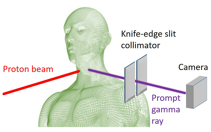 Knife-edge Prompt Gamma camera setup for head and neck cancer patient