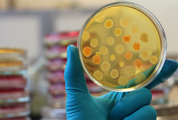 Scientist holding petri dish