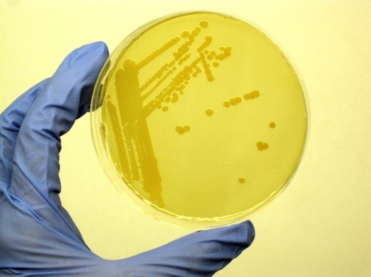 Petri dish with S aureus