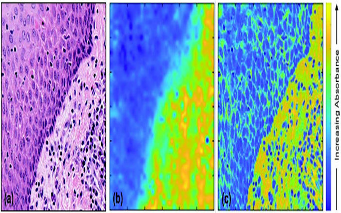 Image Fusion for Cancer Diagnosis