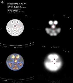 CT and SPECT of the Liverpool Phantom for MTRL/SPECT/CT Imaging