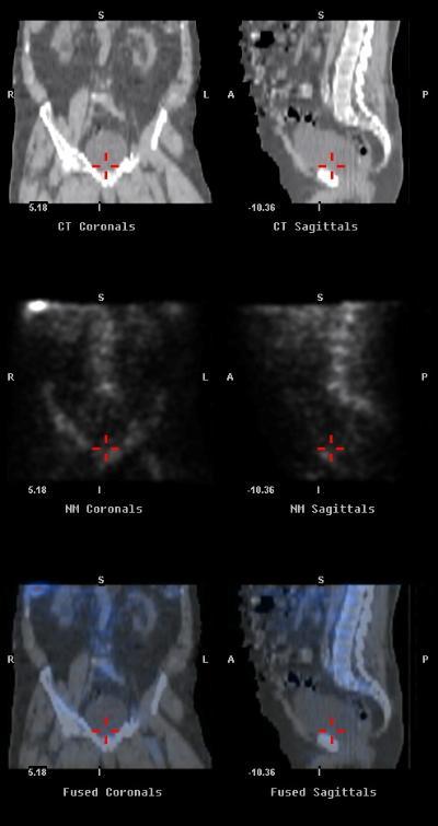 SPECT, CT and SPECT/CT for the MTRL images page