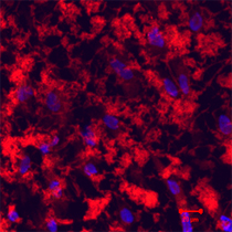 Mesenchymal stem cells