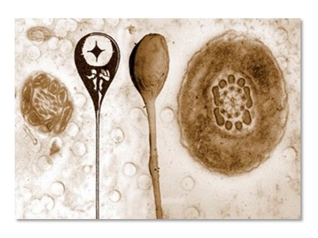 A screenprint created for the ‘Designs for Life’ project run by Dr. Paul Harrison at The University of Dundee. It illustrates the progression in microscopy techniques over the years, first, a drawing of what Antonie van Leeuwenhoek saw when he looked at mouse sperm down a microscope, compared with electron microscope images of spermatozoa.