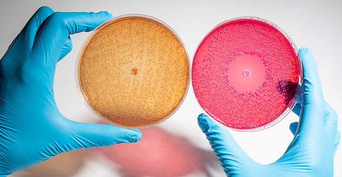 Scientist holding pink and orange petri dishes